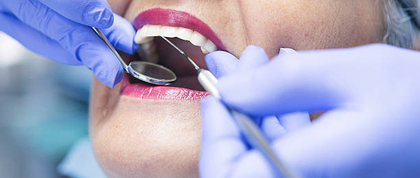 Best Emergency Tooth Extraction in Claremont, NC